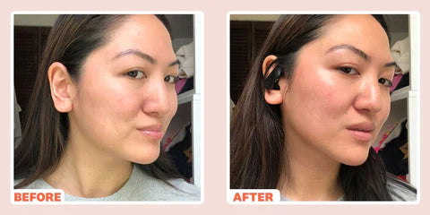 Facial Toning Device with LED Light Therapy