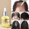 SAVVYHIGH - PURC Hair Growth Essential Oil - Reclaim Your Luscious Locks