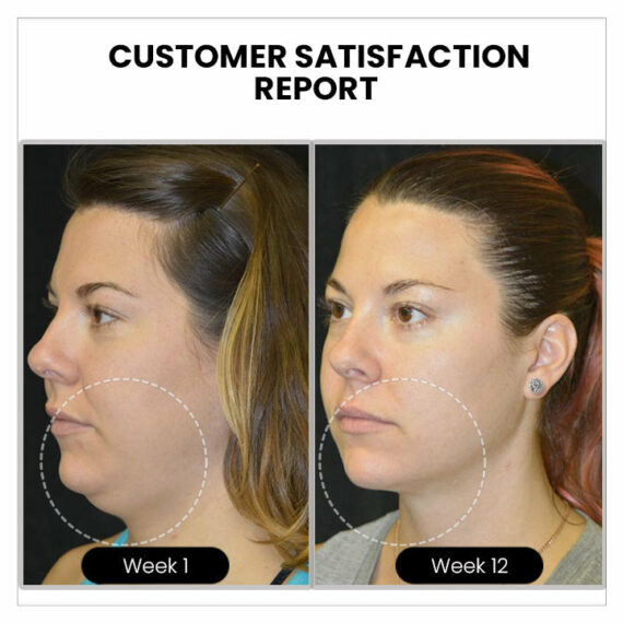 Atheniz Acupuncture Earrings (Limited time discount last