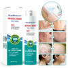 ScarRemove Advanced Scar Spray For All Types of Scars - For example Acne Scars, Surgical Scars and Stretch Marks