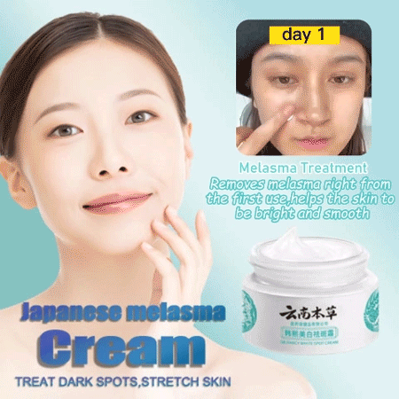 HANCY Yunnan Herbal Whitening and Freckle - Removing Cream: Fades Spots and Brightens Skin Tone