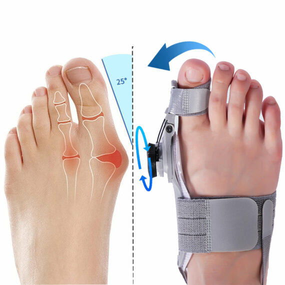 Treatmedy Bunion Fix Natural AtHome Bunion Relief Lulunami