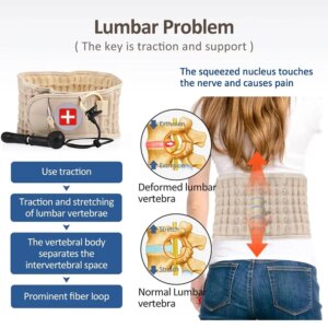 BackReliever - Instant Relief from Back Pain & Sciatica